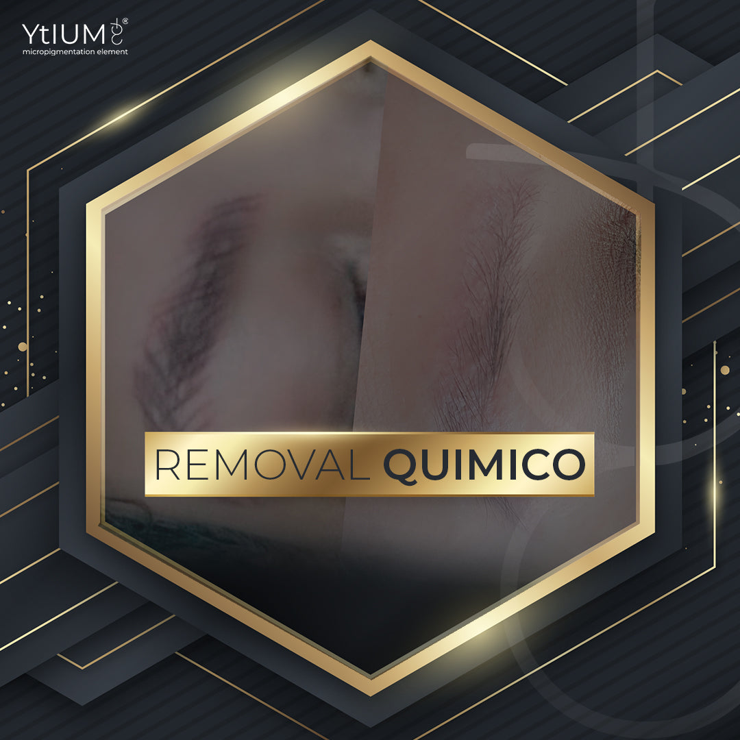 Removal Químico